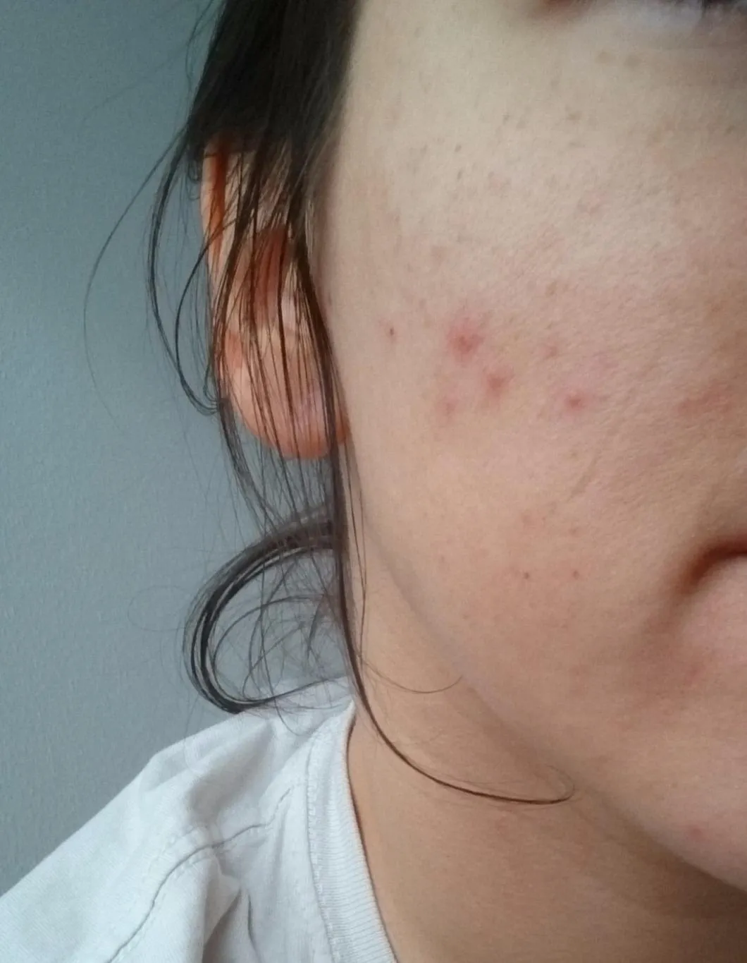 Luvos Heilerde 2 hautfein Pulver 480 g Akne Maske